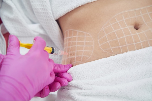 fat dissolving injection treatment for reducing belly fat