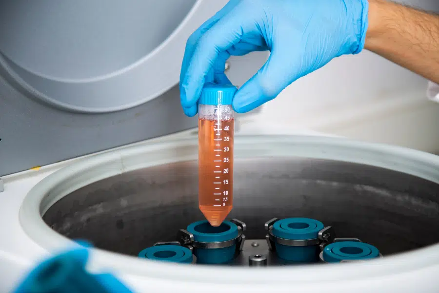 The Crucial Role of Centrifugation in Platelet-Rich Plasma Treatment